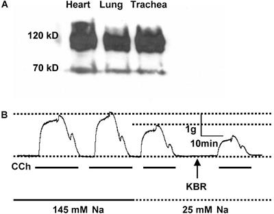 Na+/Ca2+ Exchanger 1 in Airway Smooth Muscle of Allergic Inflammation Mouse Model